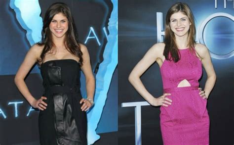 alexandra daddario breast reduction|Alexandra Daddario Breast Augmentation Journey